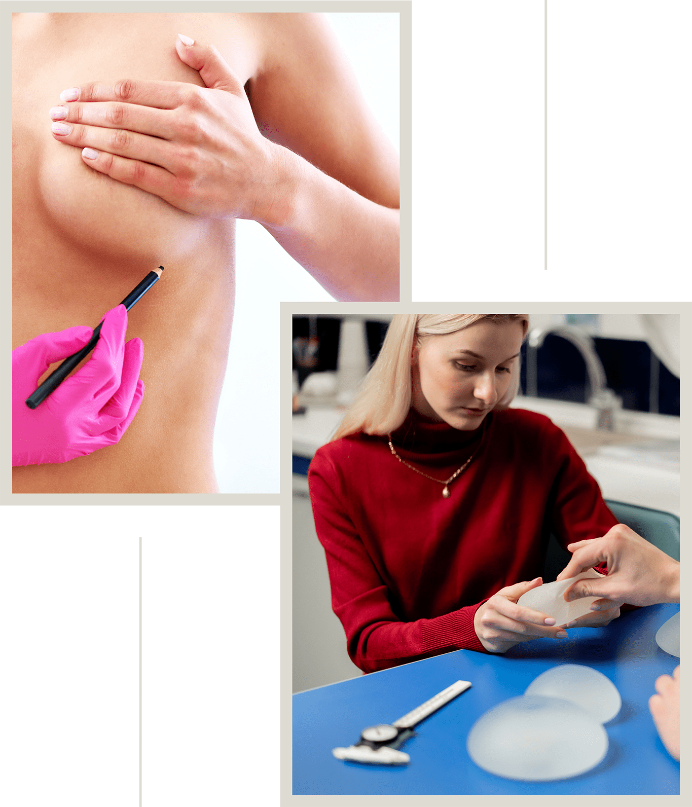 A collage of breast augmentation.