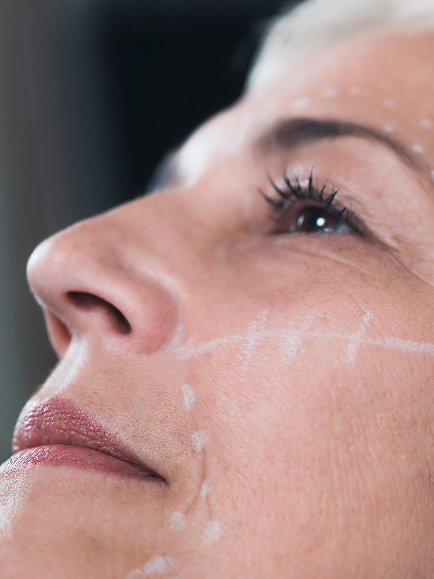 A woman getting a facelift