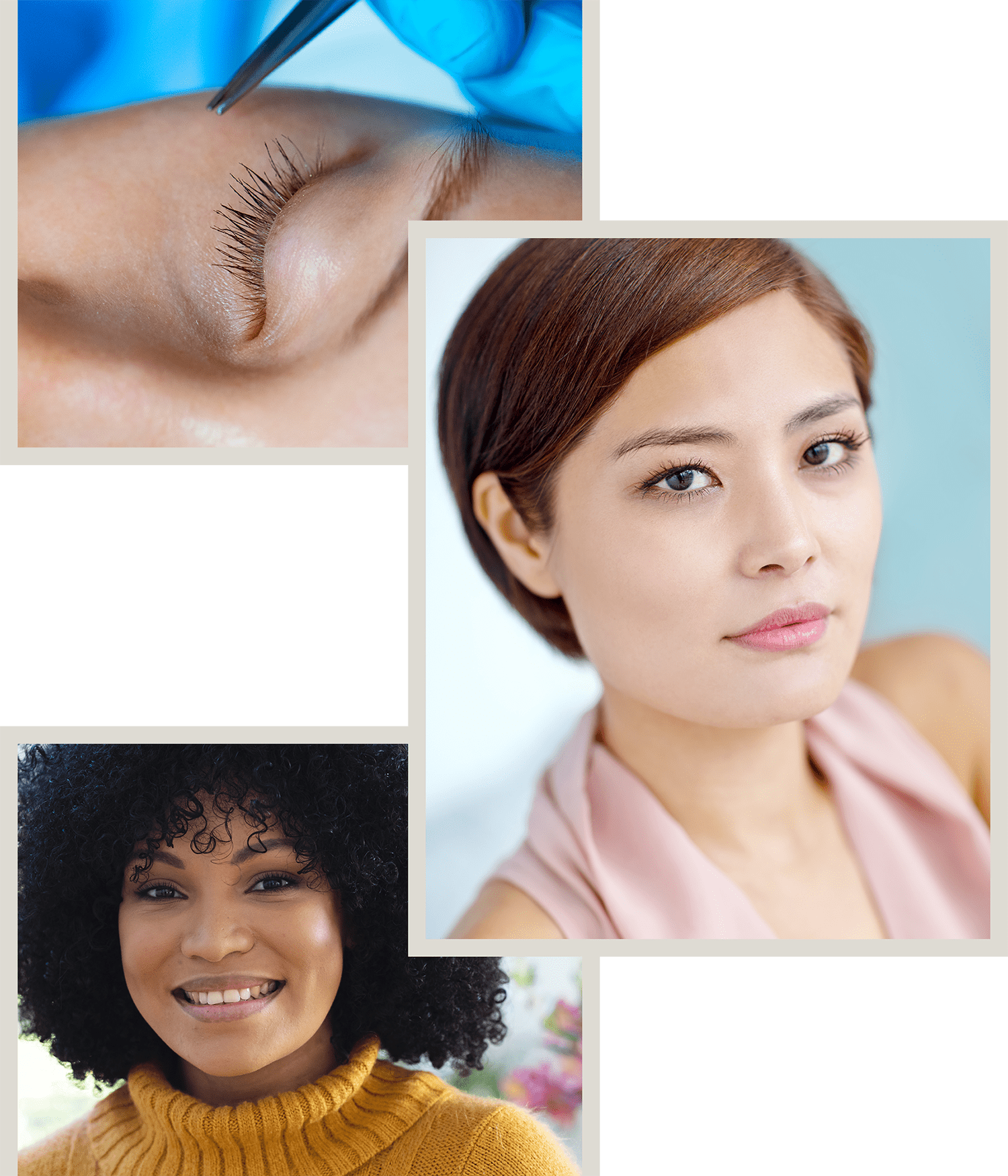A collage of eyelid surgery.